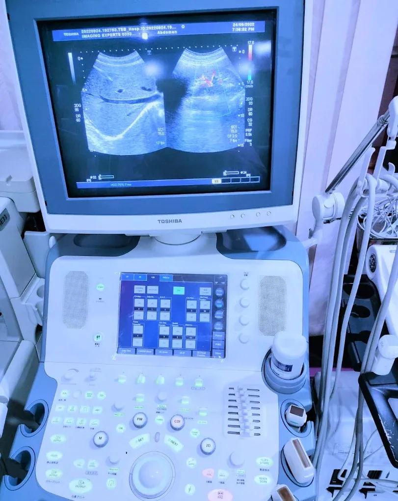 Gallery photo of Dr Bilal Aziz (FCPS, Consultant Radiologist & Ultrasound specialist)