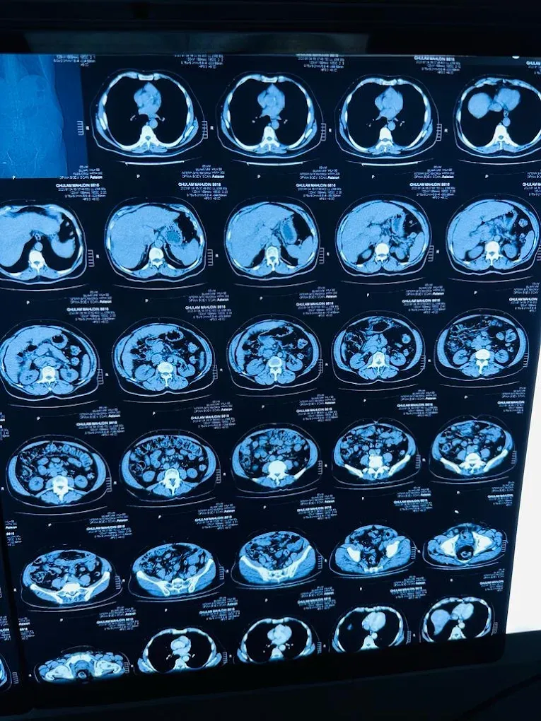 Gallery photo of Dr Bilal Aziz (FCPS, Consultant Radiologist & Ultrasound specialist)