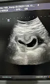 Gallery photo of Dr Bilal Aziz (FCPS, Consultant Radiologist & Ultrasound specialist)