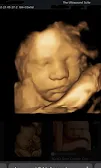 Gallery photo of Dr Bilal Aziz (FCPS, Consultant Radiologist & Ultrasound specialist)